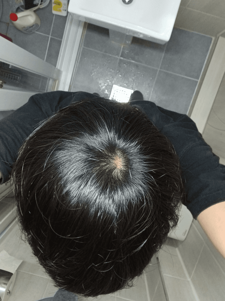 1번 째 사진