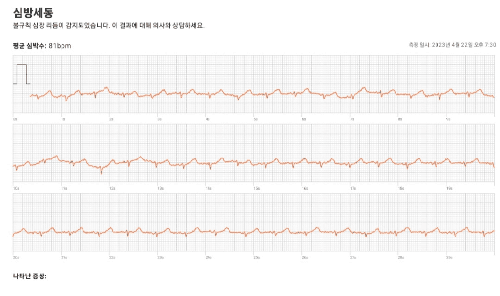 2번 째 사진