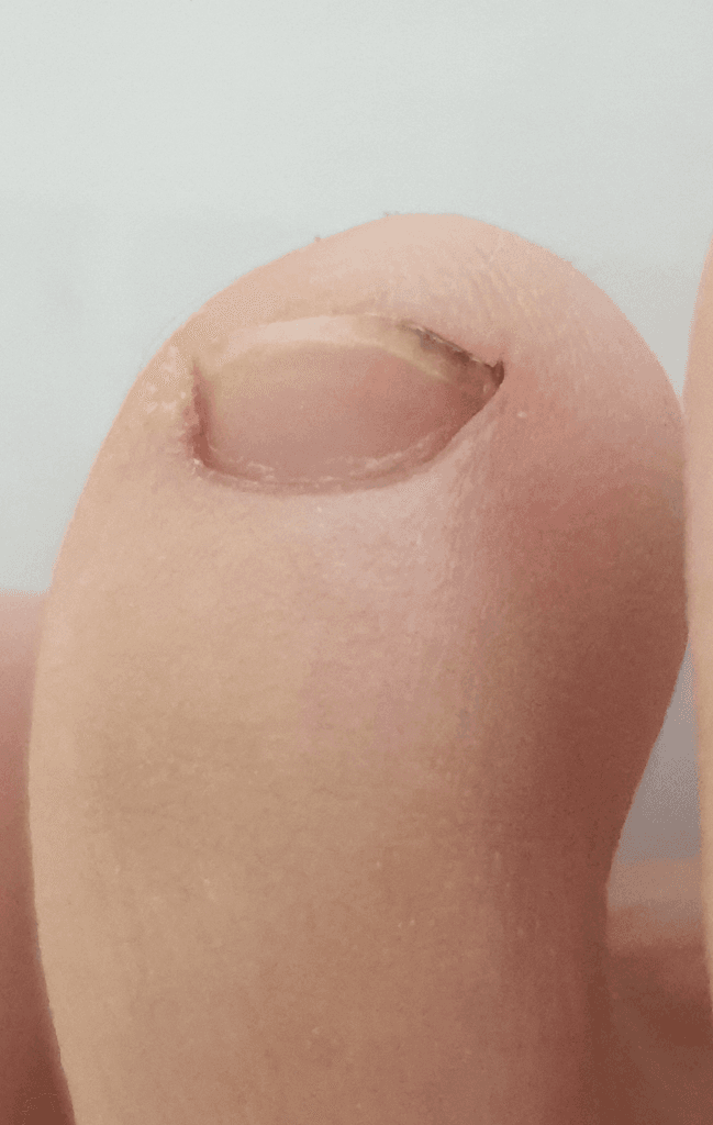 2번 째 사진