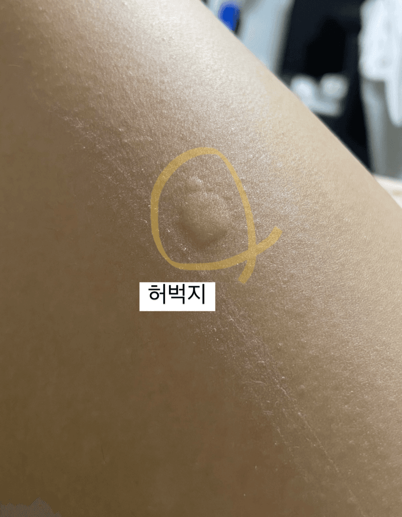 2번 째 사진
