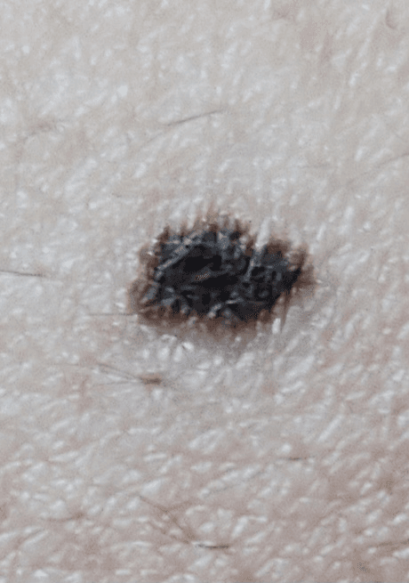 2번 째 사진