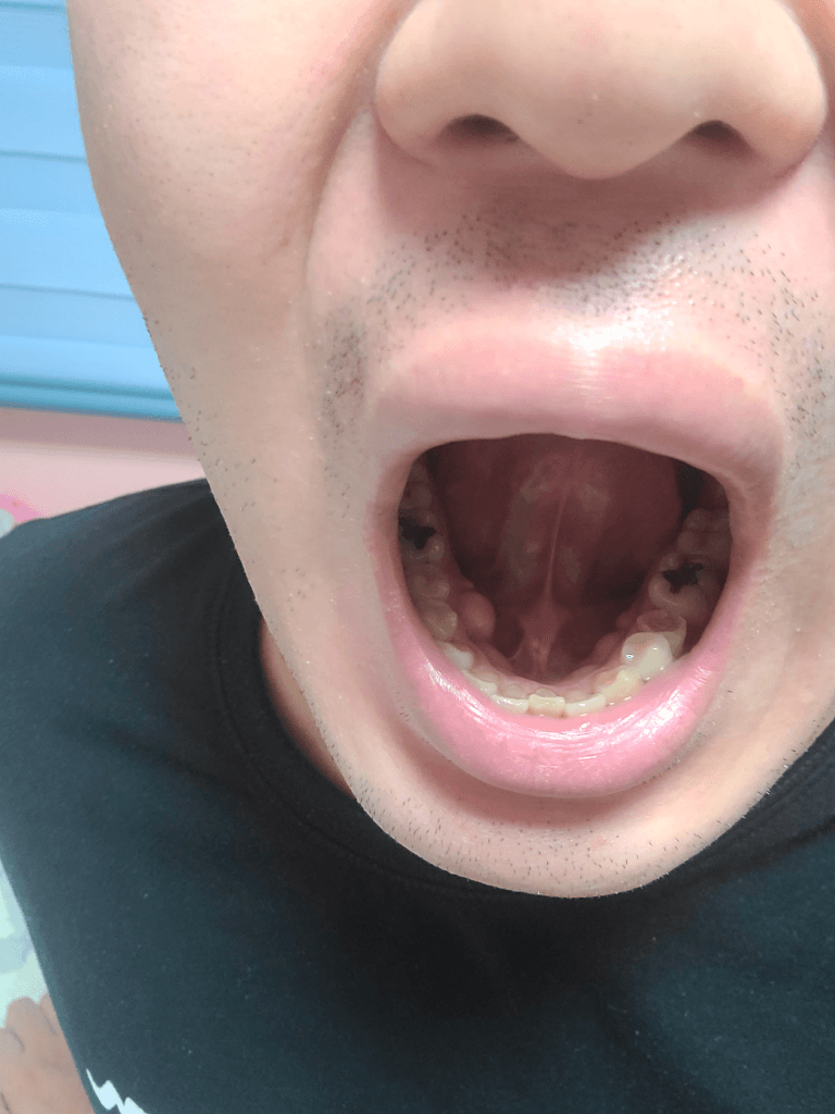 2번 째 사진