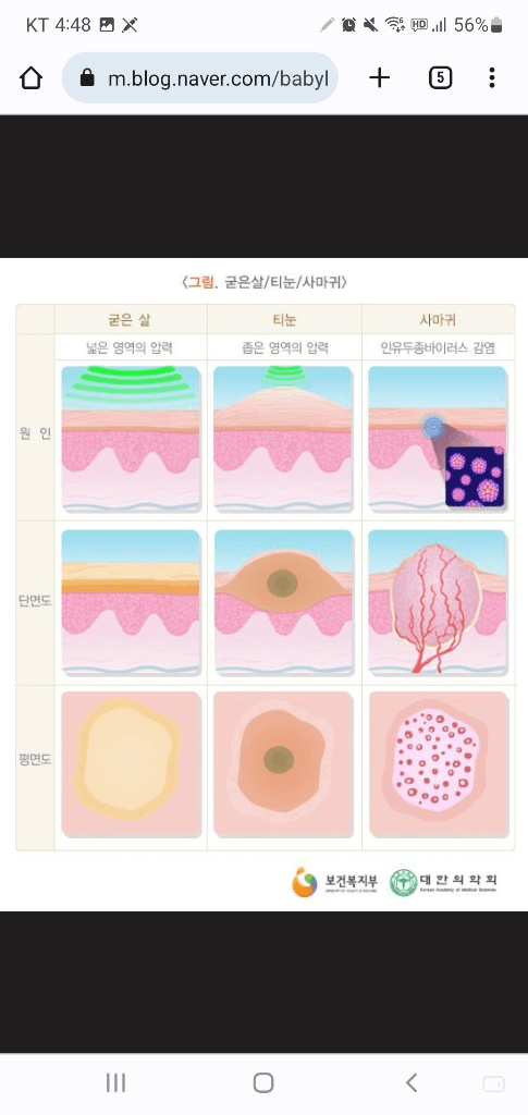 2번 째 사진