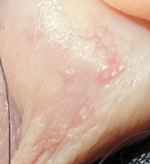 3번 째 사진