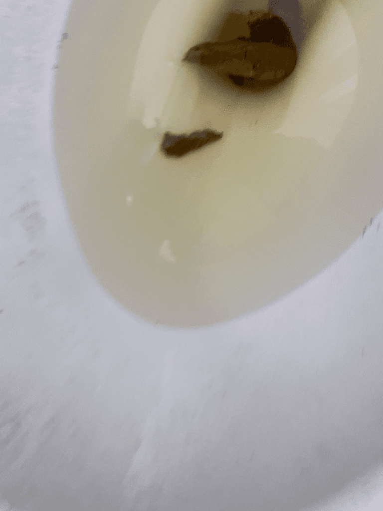 2번 째 사진