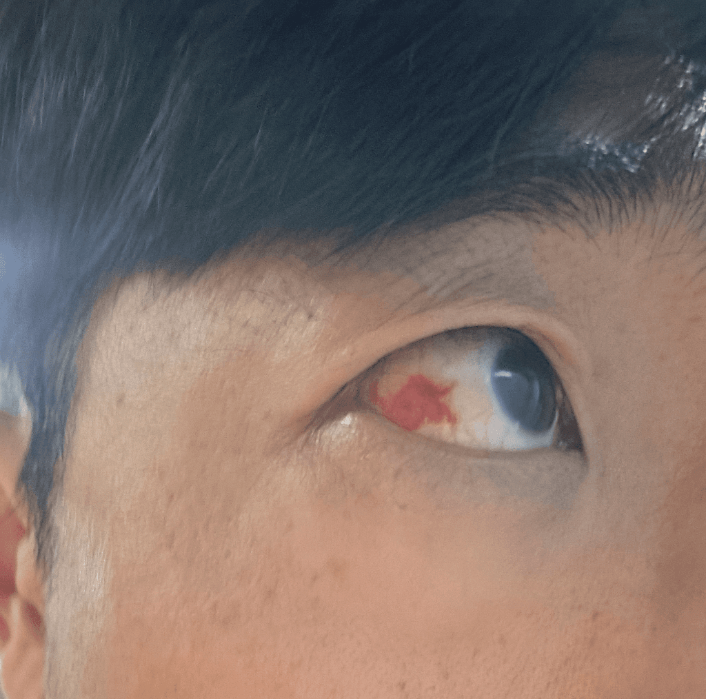 1번 째 사진