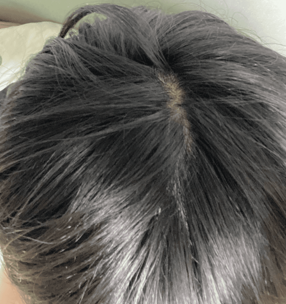 9번 째 사진