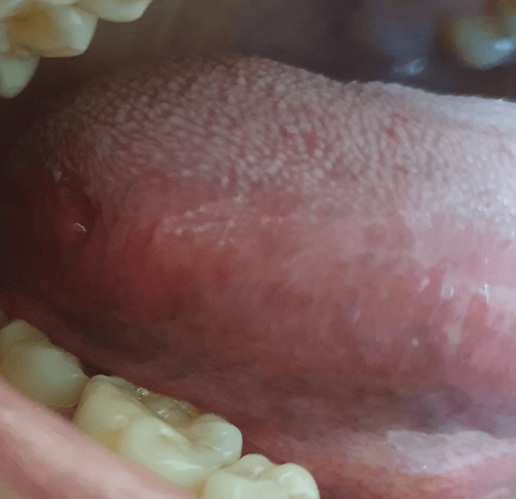 3번 째 사진