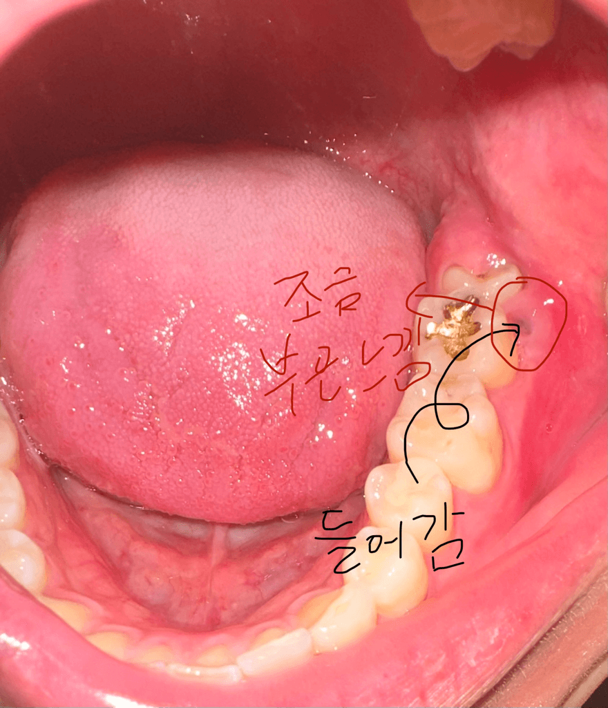 1번 째 사진