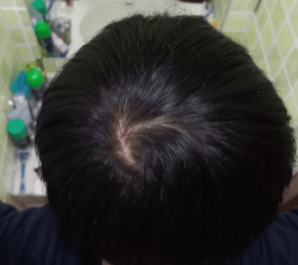 3번 째 사진