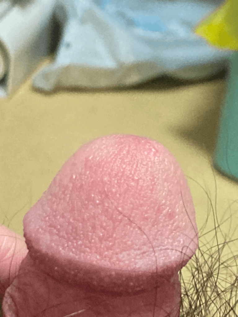2번 째 사진