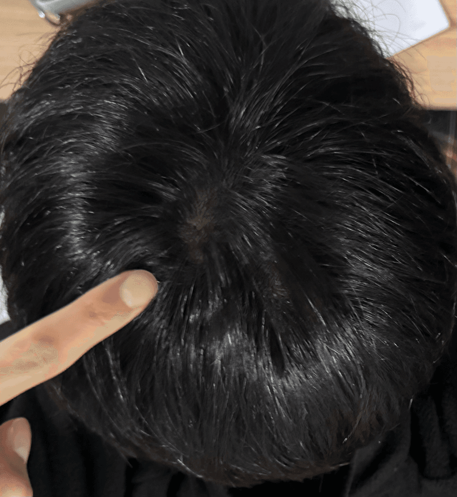 2번 째 사진