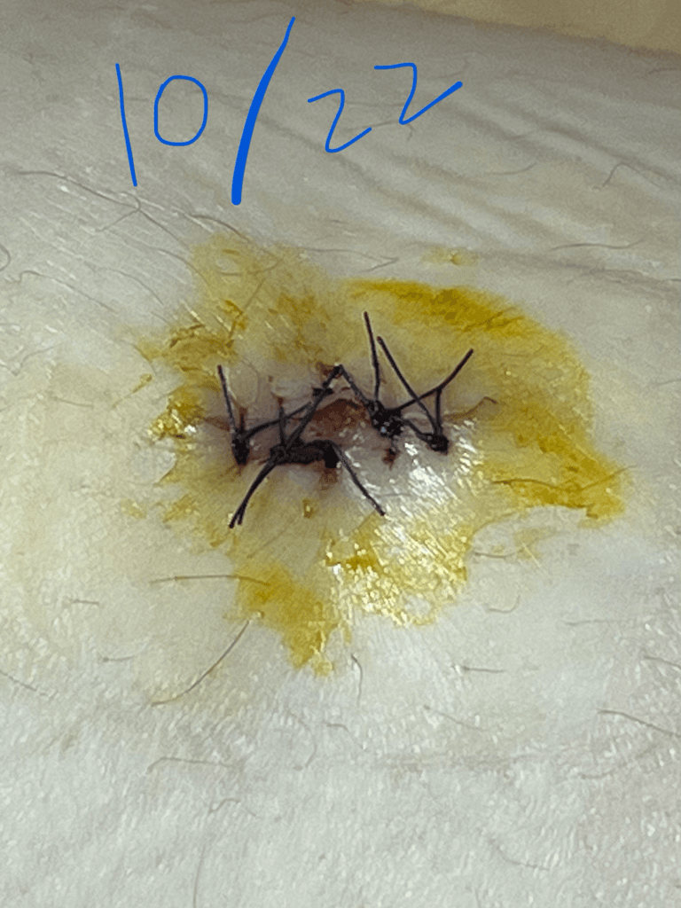 2번 째 사진