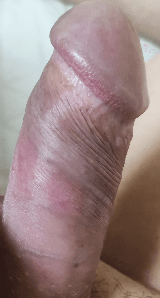 2번 째 사진