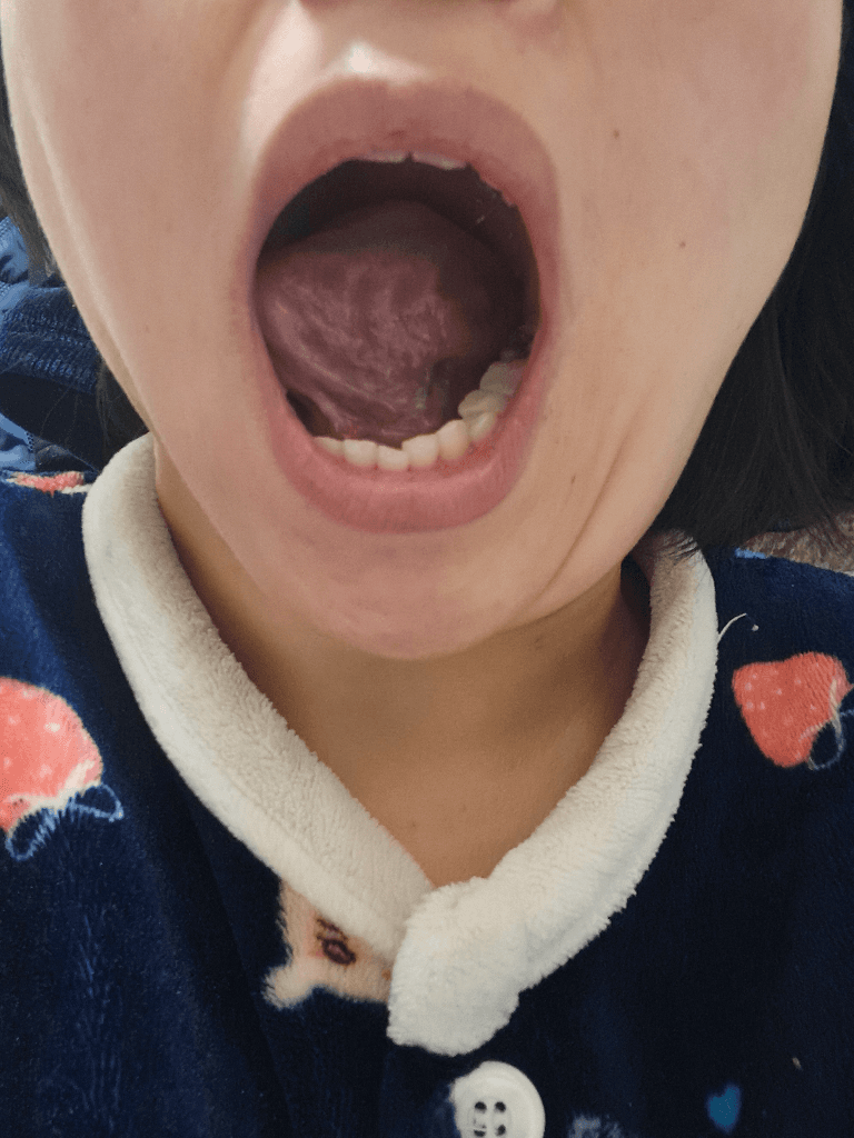 2번 째 사진