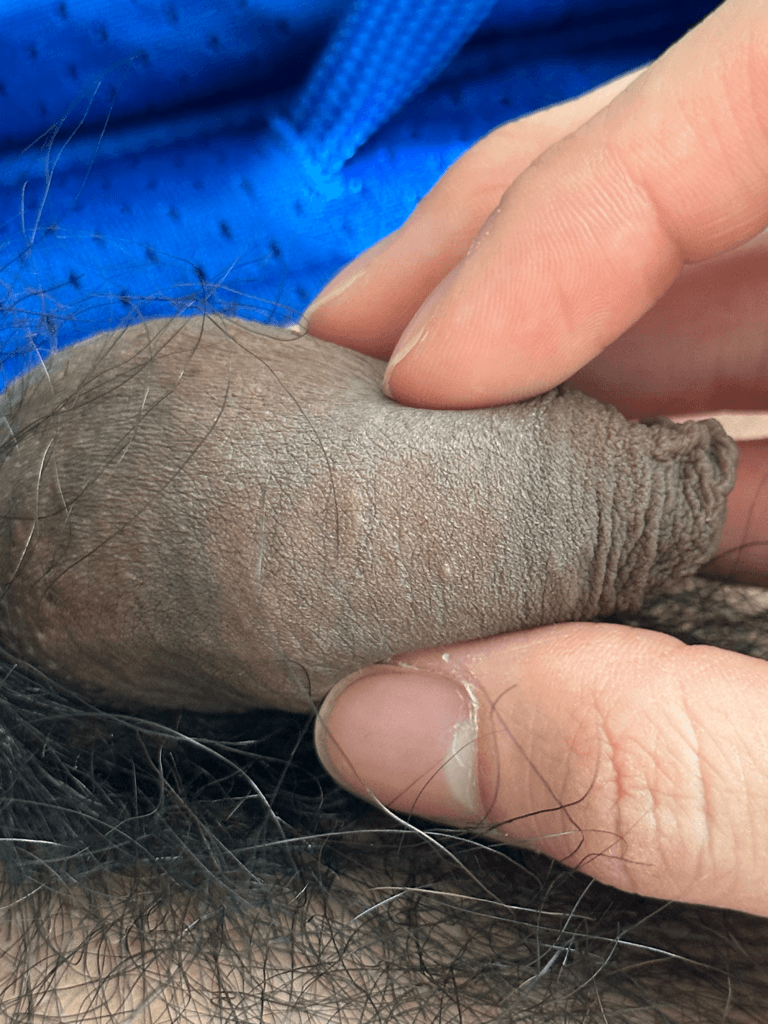 2번 째 사진