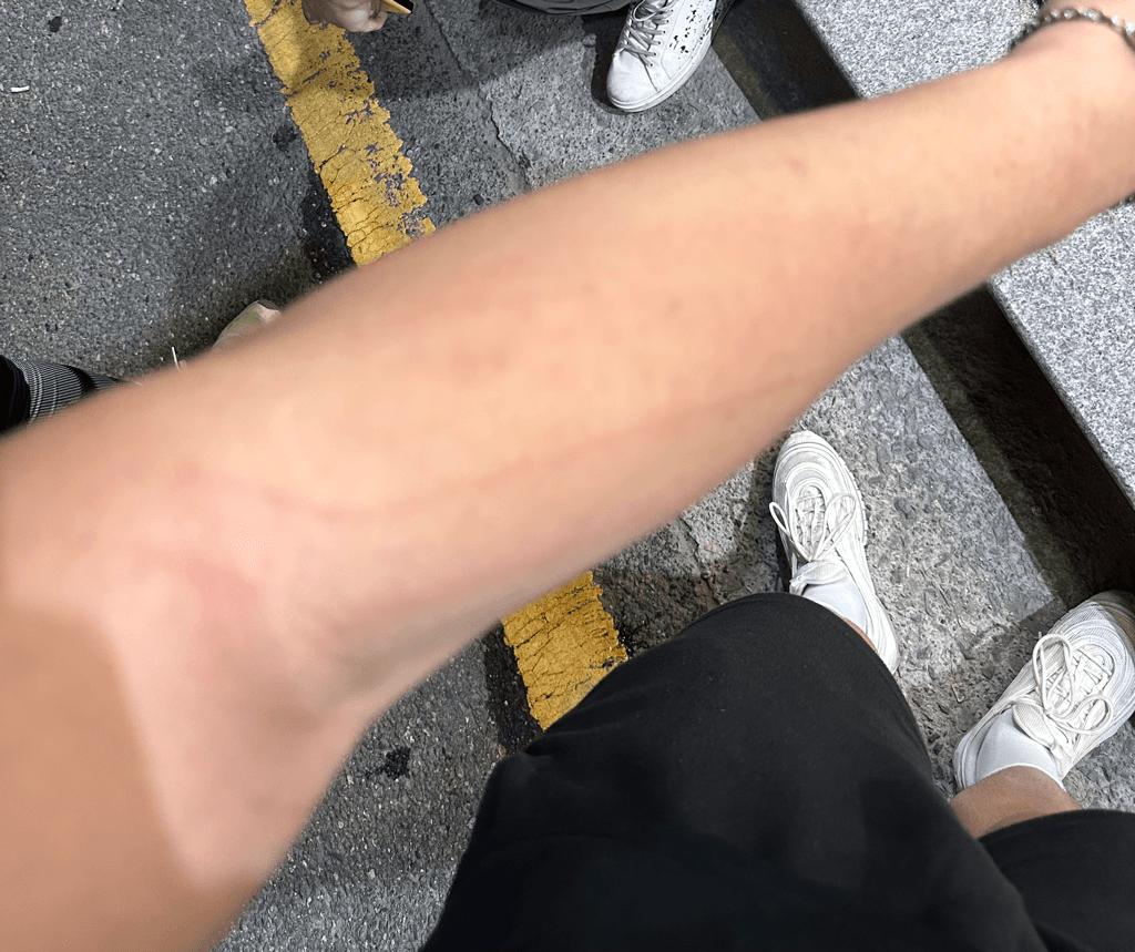 2번 째 사진