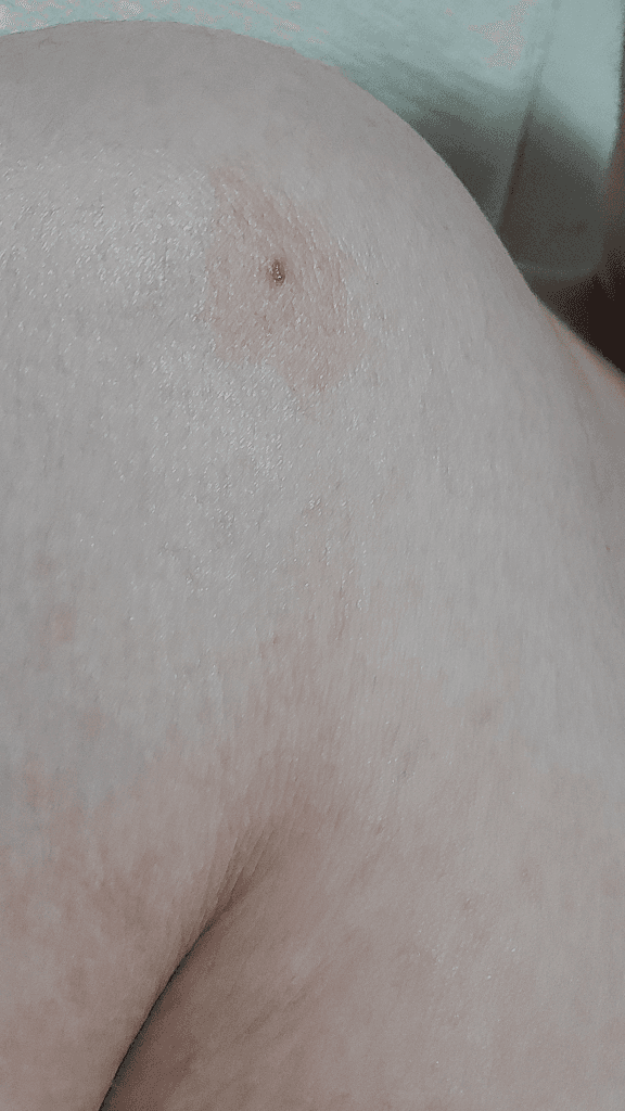 2번 째 사진