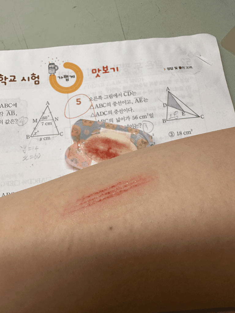 2번 째 사진