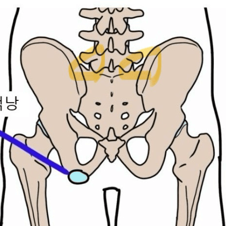 3번 째 사진
