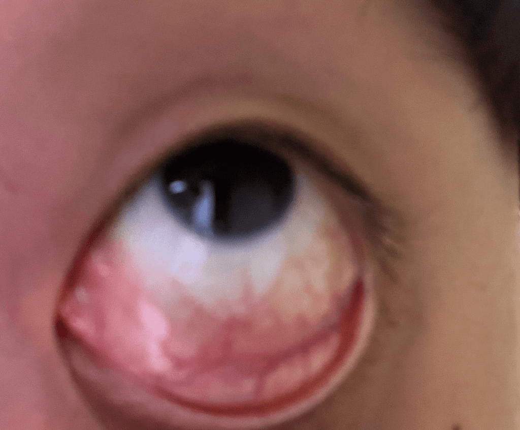 2번 째 사진
