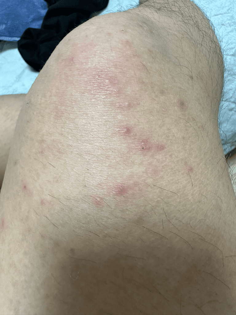 2번 째 사진