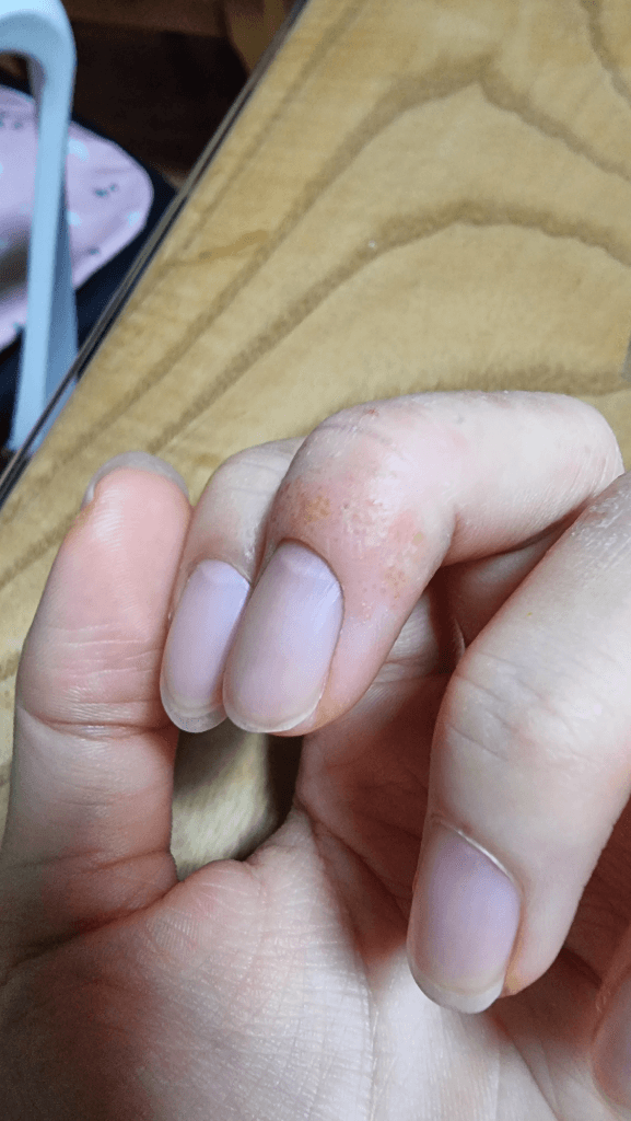 2번 째 사진
