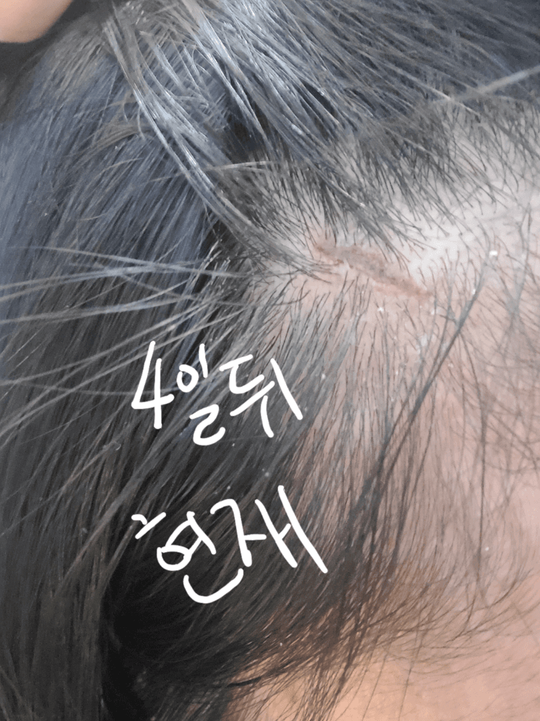 3번 째 사진