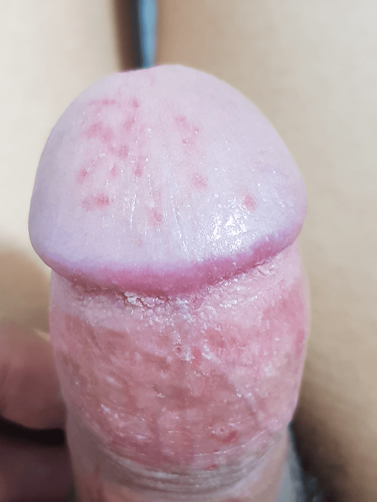 2번 째 사진