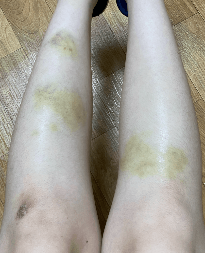 1번 째 사진
