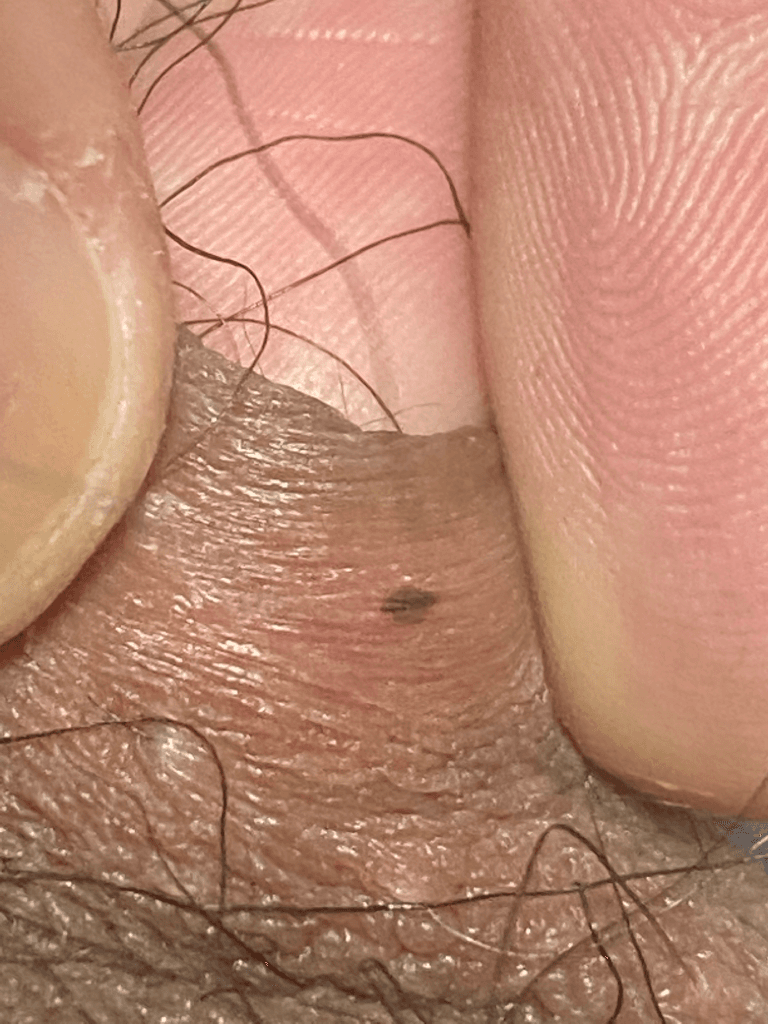 3번 째 사진