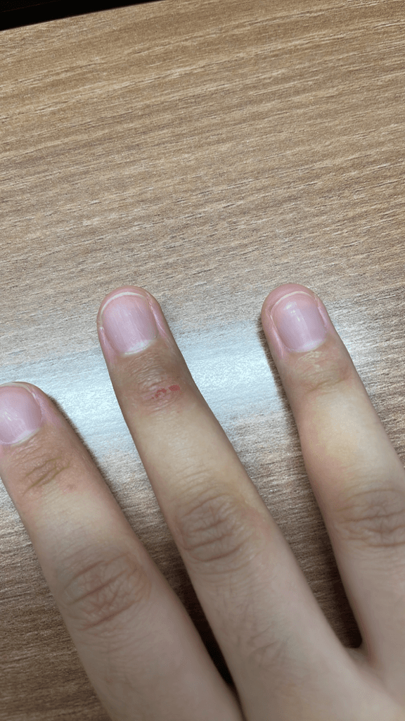 1번 째 사진