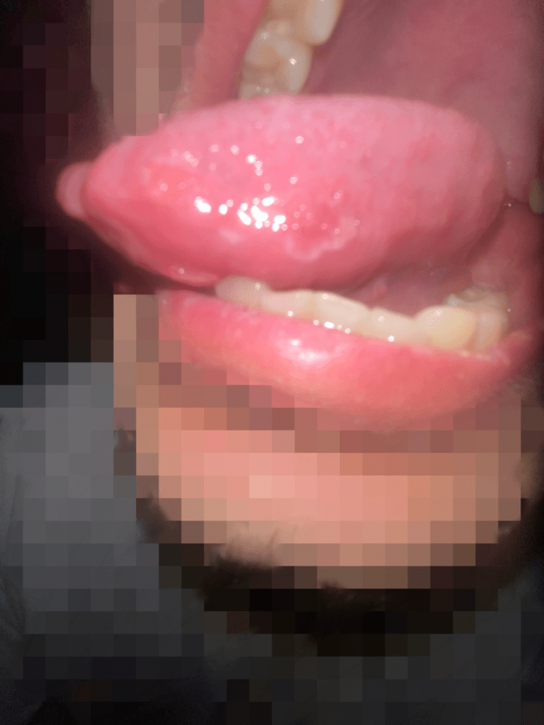 2번 째 사진
