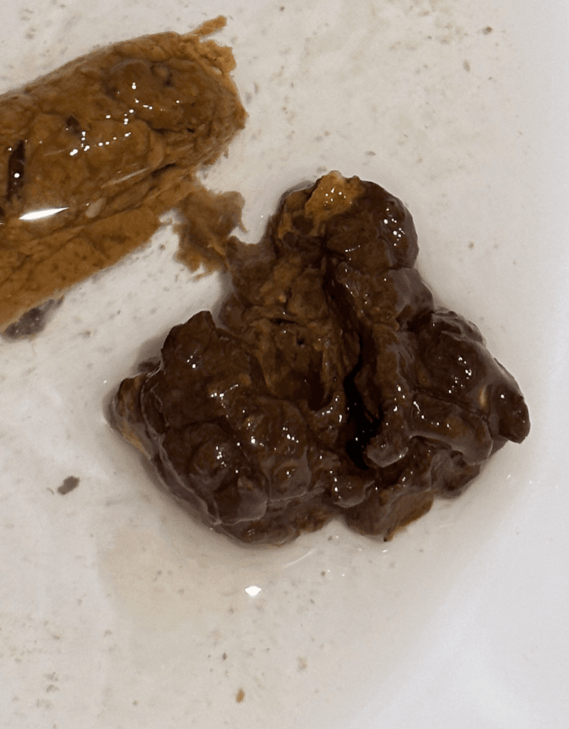 2번 째 사진
