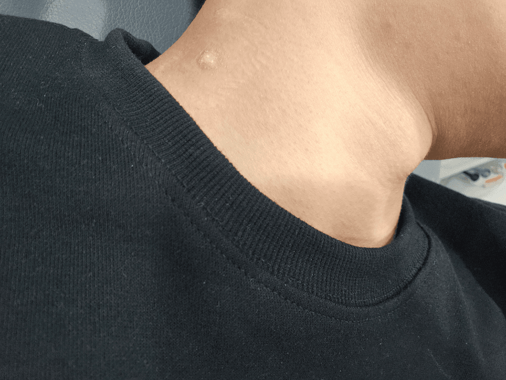 4번 째 사진