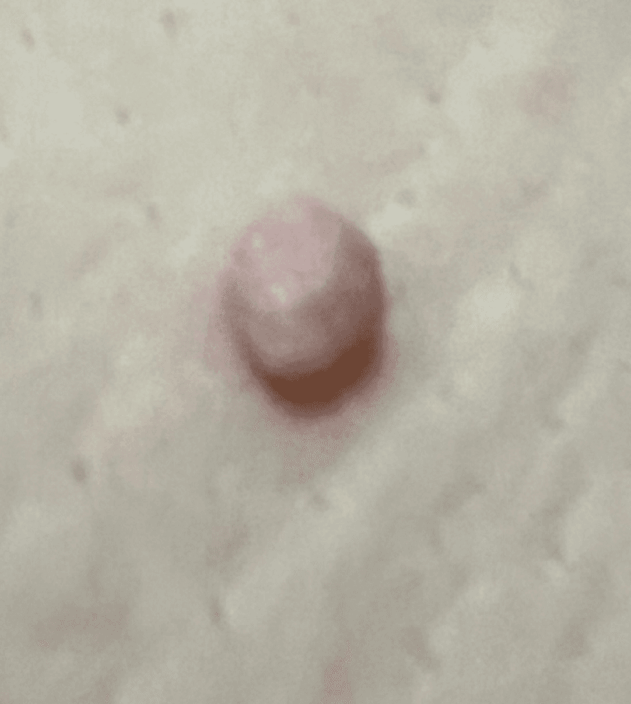 2번 째 사진