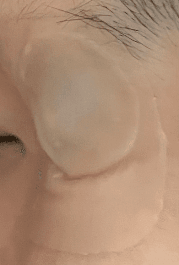 3번 째 사진