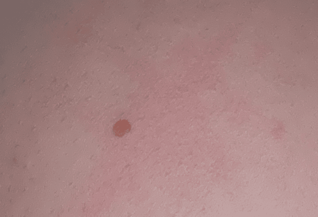 2번 째 사진