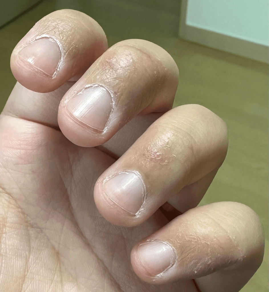 2번 째 사진