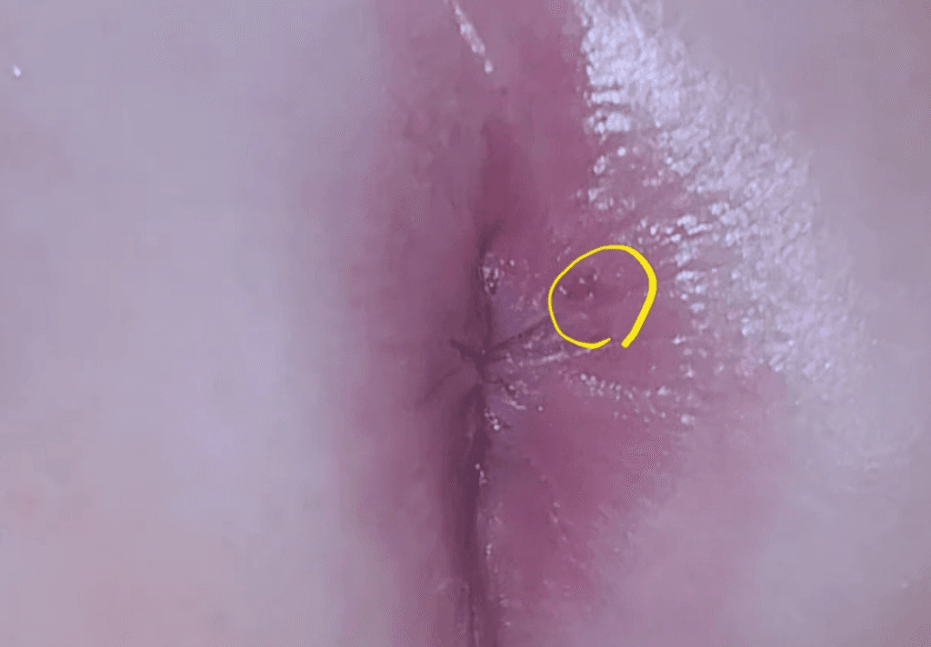 2번 째 사진