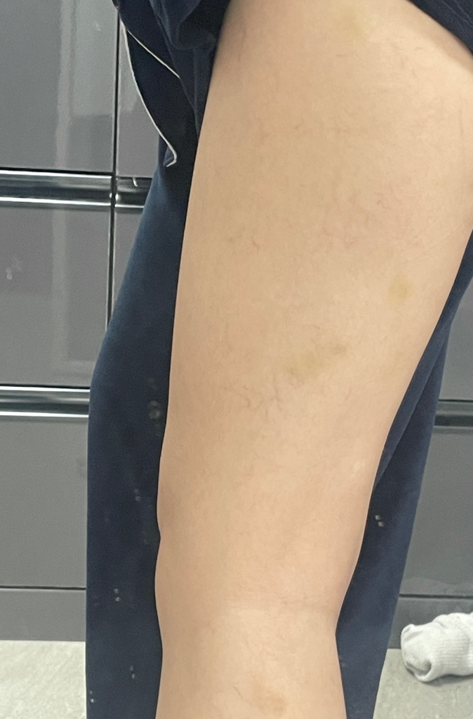 2번 째 사진