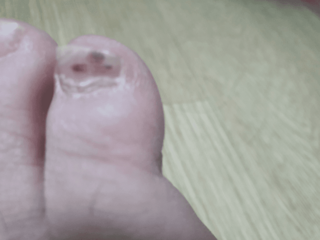 2번 째 사진
