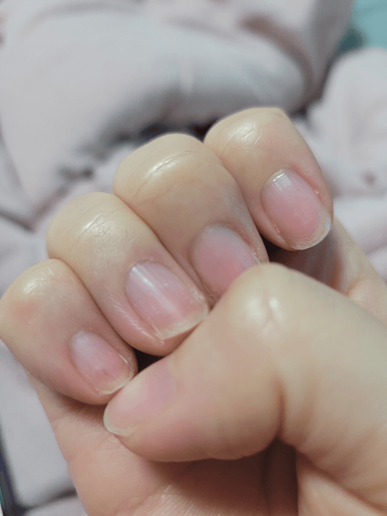 2번 째 사진