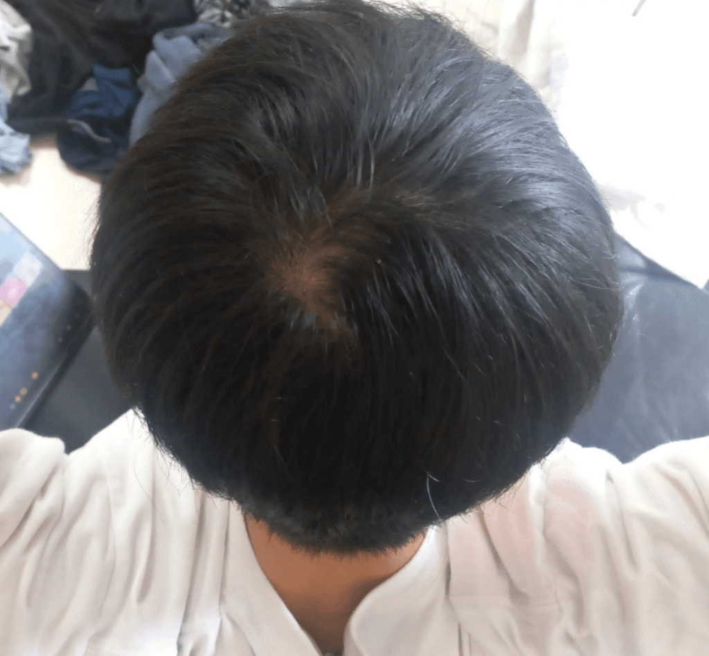 1번 째 사진