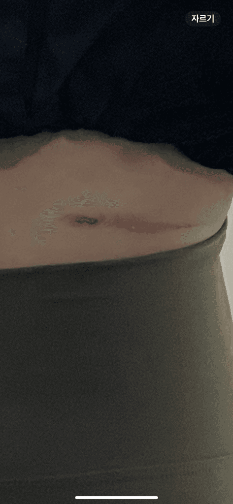 3번 째 사진