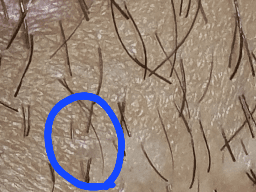 2번 째 사진