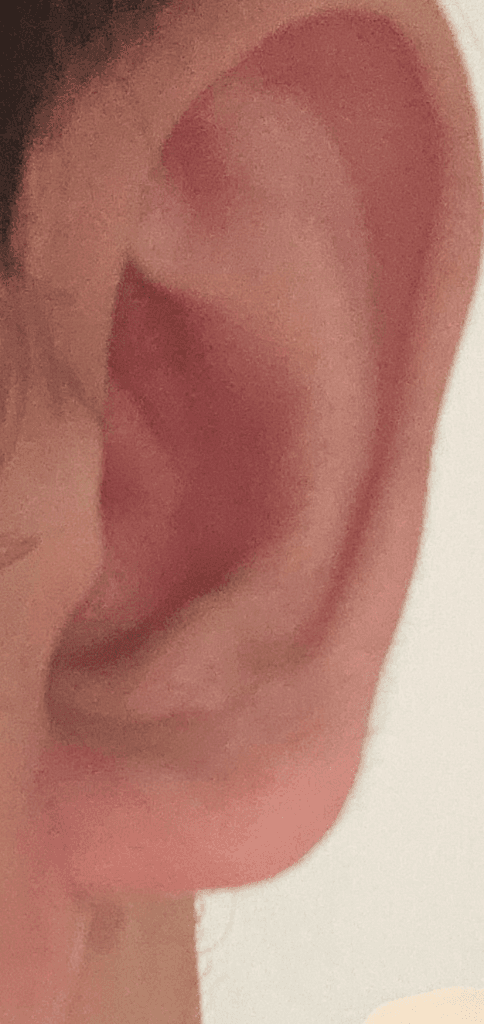2번 째 사진