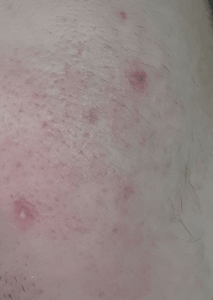 2번 째 사진