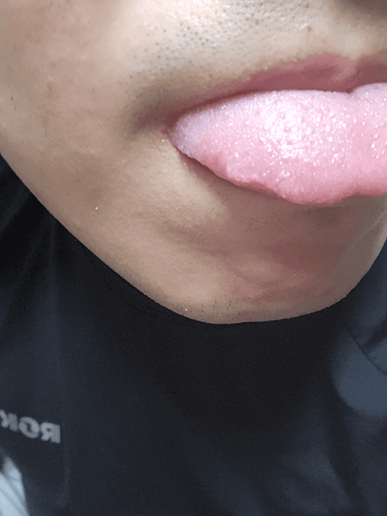 3번 째 사진