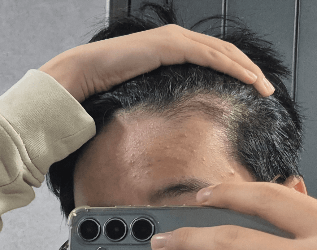 1번 째 사진